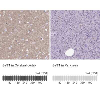 Immunohistochemistry-Paraffin: Synaptotagmin 1 Antibody [NBP1-87362]