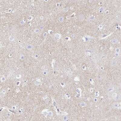 Immunohistochemistry-Paraffin: Synaptotagmin 1 Antibody [NBP2-34215]