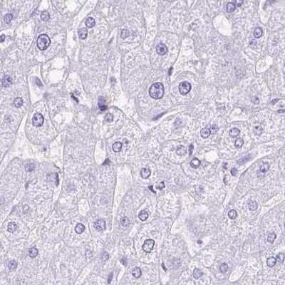 Immunohistochemistry-Paraffin: Synaptotagmin 1 Antibody [NBP2-34215]