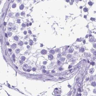 Immunohistochemistry-Paraffin: Synaptotagmin 1 Antibody [NBP2-34215]