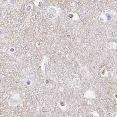 Immunohistochemistry-Paraffin: Synaptotagmin 1 Antibody [NBP2-34215]