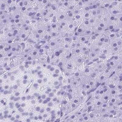 Immunohistochemistry-Paraffin: Synaptotagmin 1 Antibody [NBP2-34215]