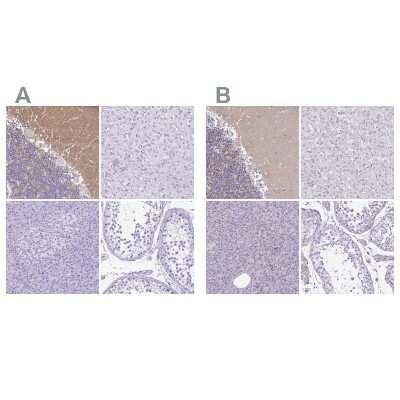 Immunohistochemistry-Paraffin: Synaptotagmin 1 Antibody [NBP2-34215]