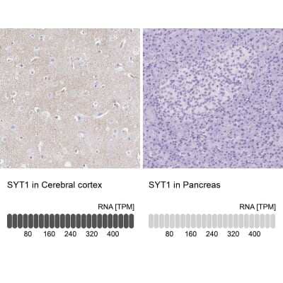 Immunohistochemistry-Paraffin: Synaptotagmin 1 Antibody [NBP2-34215]