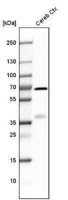 Western Blot: Synaptotagmin 1 Antibody [NBP1-87362]