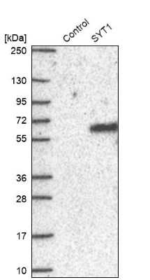 Western Blot: Synaptotagmin 1 Antibody [NBP2-34215]