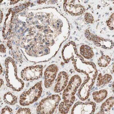 Immunohistochemistry-Paraffin: Synaptotagmin 12 Antibody [NBP1-87001]