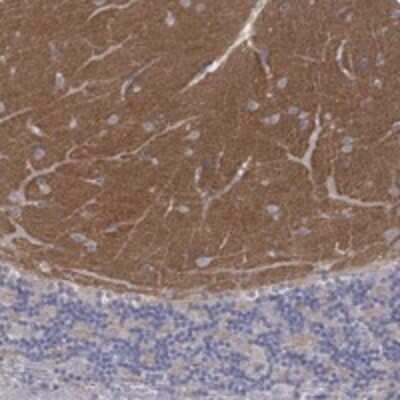 Immunohistochemistry-Paraffin: Synaptotagmin 12 Antibody [NBP3-17315]