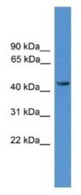 Western Blot: Synaptotagmin 12 Antibody [NBP1-69103]