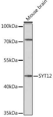 Western Blot: Synaptotagmin 12 AntibodyAzide and BSA Free [NBP3-15537]