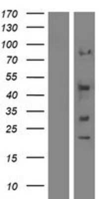 Western Blot: Synaptotagmin 12 Overexpression Lysate [NBP2-05003]