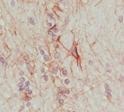 Immunohistochemistry-Paraffin: Synaptotagmin 13 Antibody [NBP1-92466]