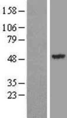 Western Blot: Synaptotagmin 13 Overexpression Lysate [NBL1-16649]