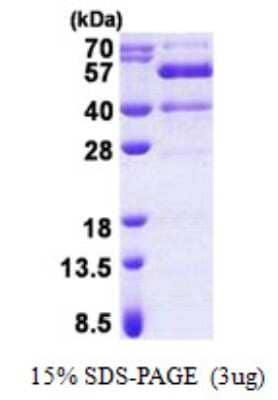 SDS-PAGE: Recombinant Human Synaptotagmin 13 His Protein [NBP2-22839]