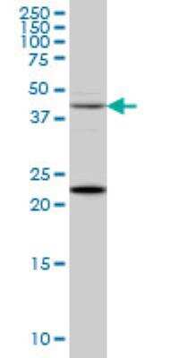 Western Blot: Synaptotagmin 2 Antibody (1G10) [H00127833-M01]
