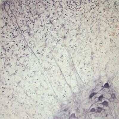 Immunohistochemistry: Synaptotagmin 2 Antibody [NB100-91297]