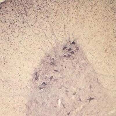 Immunohistochemistry: Synaptotagmin 2 Antibody [NB100-91297]