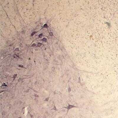 Immunohistochemistry: Synaptotagmin 2 Antibody [NB100-91297]
