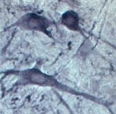 Immunohistochemistry: Synaptotagmin 2 Antibody [NB100-91297]