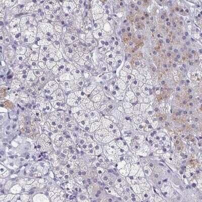 Immunohistochemistry-Paraffin: Synaptotagmin 2 Antibody [NBP2-49403]