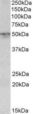 Western Blot: Synaptotagmin 2 Antibody [NBP1-68859]