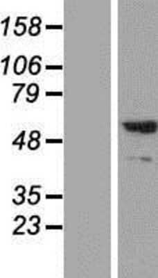 Western Blot: Synaptotagmin 2 Overexpression Lysate [NBP2-05032]