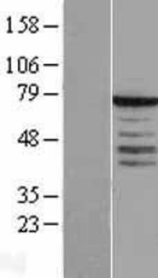 Western Blot: Synaptotagmin 3 Overexpression Lysate [NBL1-16651]