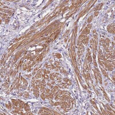 Immunohistochemistry-Paraffin: Synaptotagmin 4 Antibody [NBP2-13408]