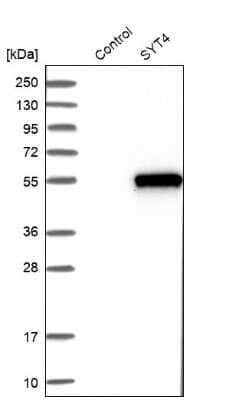 Western Blot: Synaptotagmin 4 Antibody [NBP2-13408]