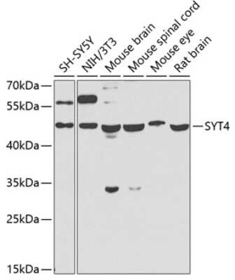 Western Blot: Synaptotagmin 4 AntibodyBSA Free [NBP2-93411]