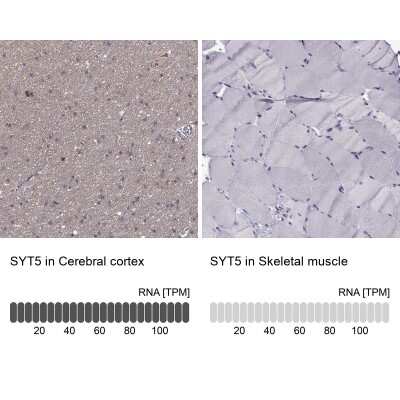 Immunohistochemistry-Paraffin: Synaptotagmin 5 Antibody [NBP2-62725]