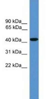 Western Blot: Synaptotagmin 5 Antibody [NBP1-69104]