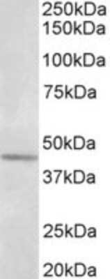 Western Blot: Synaptotagmin 5 Antibody [NBP2-26145]