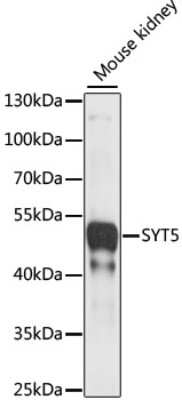 Western Blot: Synaptotagmin 5 AntibodyAzide and BSA Free [NBP2-94665]