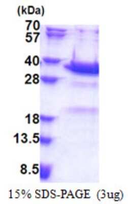 SDS-PAGE: Recombinant Human Synaptotagmin 5 His Protein [NBP2-22838]