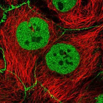 Immunocytochemistry/ Immunofluorescence: Synaptotagmin 8 Antibody [NBP2-30750]