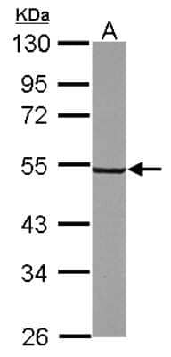 Western Blot: Synaptotagmin 6 Antibody [NBP2-20547]