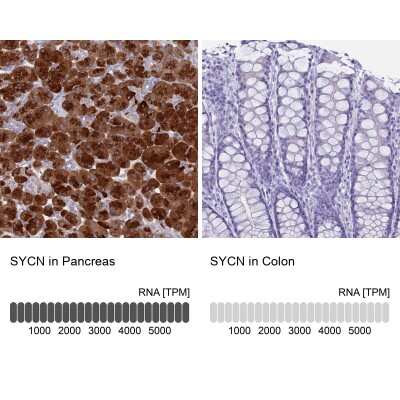 Immunohistochemistry-Paraffin: Syncollin Antibody [NBP2-13402]
