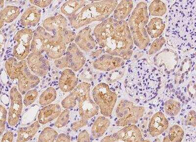 Immunohistochemistry-Paraffin: Syndecan-1/CD138 Antibody (160) [NBP2-89900]