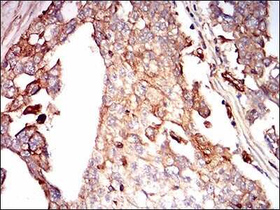 Immunohistochemistry-Paraffin: Syndecan-1/CD138 Antibody (1A3H4) - BSA Free [NBP2-37282]