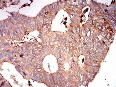 Immunohistochemistry-Paraffin: Syndecan-1/CD138 Antibody (1A3H4) - BSA Free [NBP2-37282]