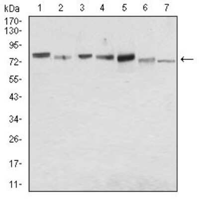 Western Blot: Syndecan-1/CD138 Antibody (1A3H4)BSA Free [NBP2-37282]