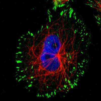 Immunocytochemistry/ Immunofluorescence: Syndecan-1/CD138 Antibody [NBP1-88135]