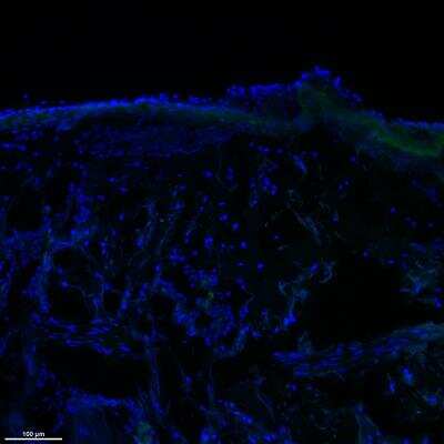 Immunohistochemistry-Frozen: Syndecan-1/CD138 Antibody [NBP1-88135]