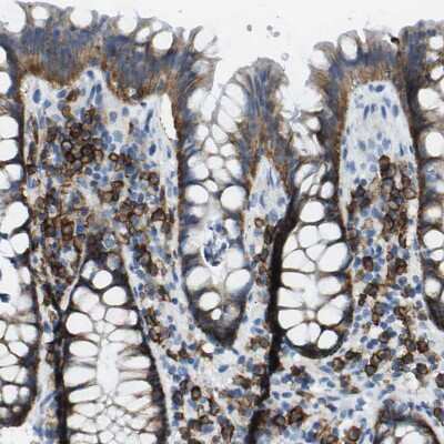 Immunohistochemistry-Paraffin: Syndecan-1/CD138 Antibody [NBP1-88135]