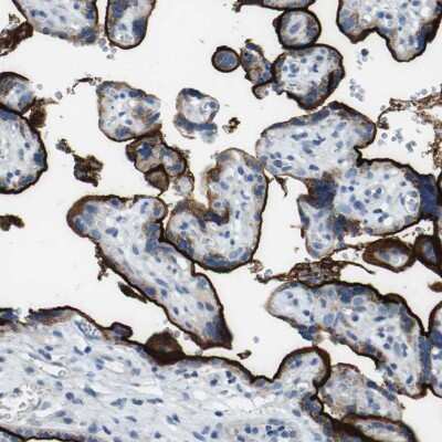 Immunohistochemistry-Paraffin: Syndecan-1/CD138 Antibody [NBP1-88135]