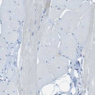 Immunohistochemistry-Paraffin: Syndecan-1/CD138 Antibody [NBP1-88135]