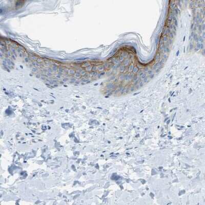 Immunohistochemistry-Paraffin: Syndecan-1/CD138 Antibody [NBP1-88135]