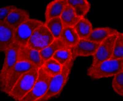 Immunocytochemistry/ Immunofluorescence: Syndecan-1/CD138 Antibody (JM11-21) [NBP2-67174]