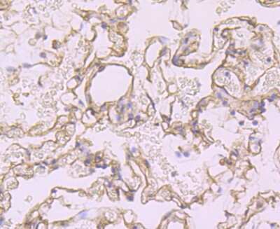 Immunohistochemistry-Paraffin: Syndecan-1/CD138 Antibody (JM11-21) [NBP2-67174]